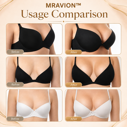 MRAVION™ Nano-Microneedle Bust Lift Patches ✨